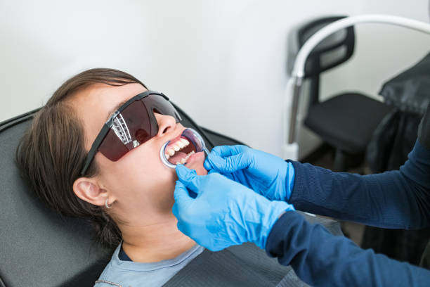 Best Emergency Wisdom Teeth Removal in Berkeley, CA